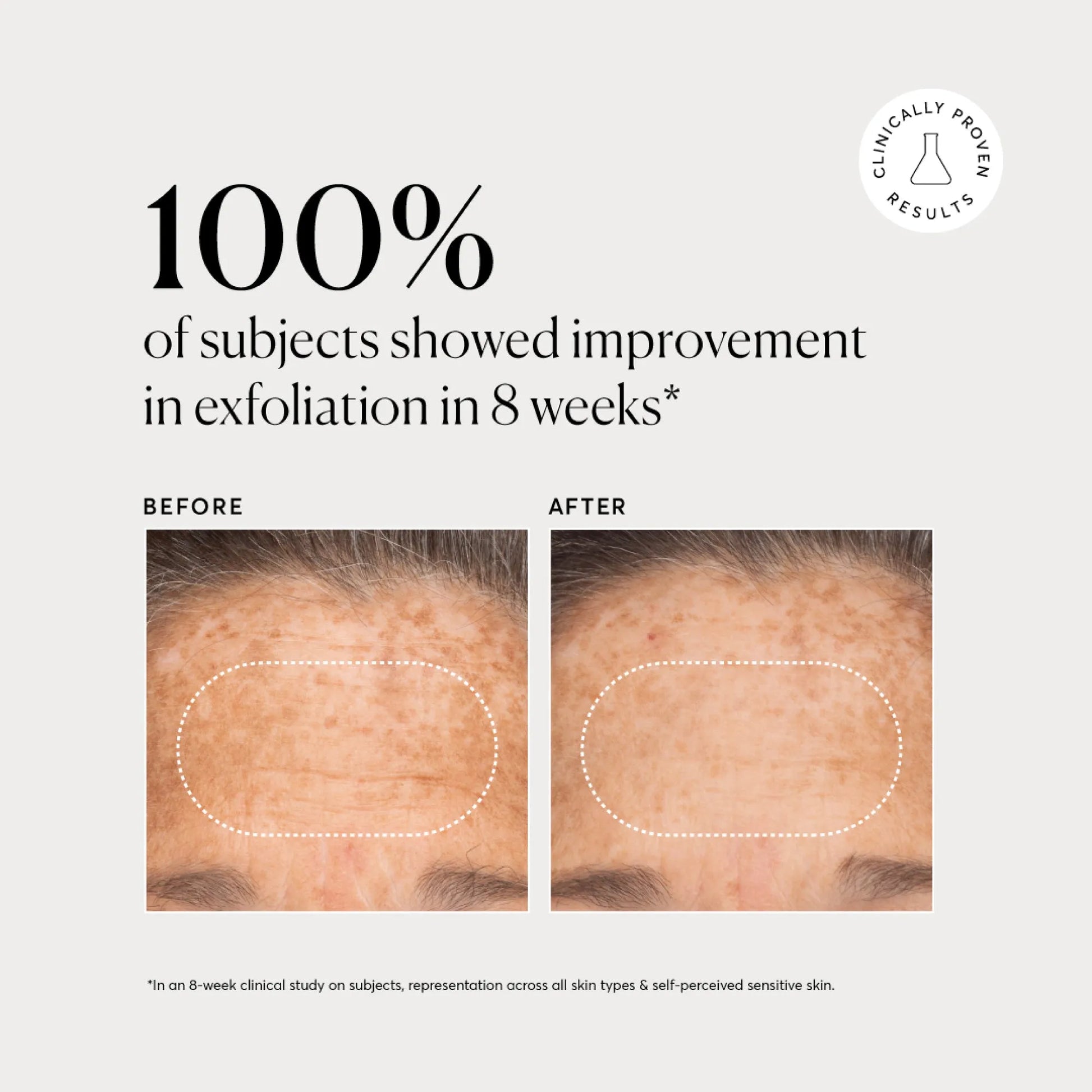 bha-liquid-exfoliant-2-s1 NATR-10027-Alt-Images-BHA-Liquid-Exfoliant-2_-03.webp